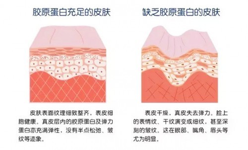 CTP胶原蛋白肽粉