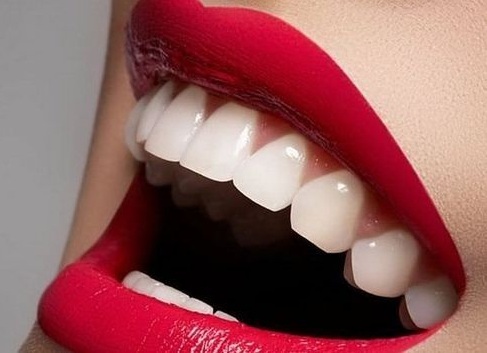 搜索牙齿美白培训